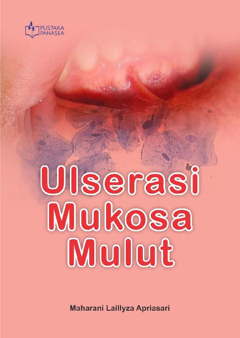 Ulserasi Mukosa Mulut